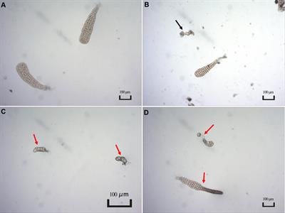 Divergence of epibacterial community assemblage correlates with malformation disease severity in Saccharina japonica seedlings
